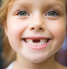 childtooth